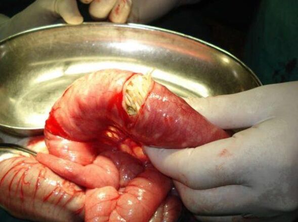 than worms are dangerous
