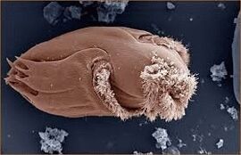 Pathogenic microorganisms in people