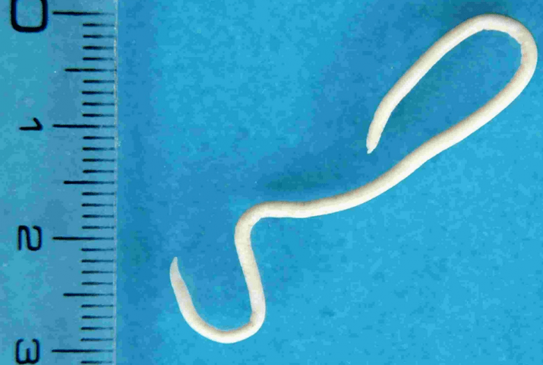 A description of human parasites