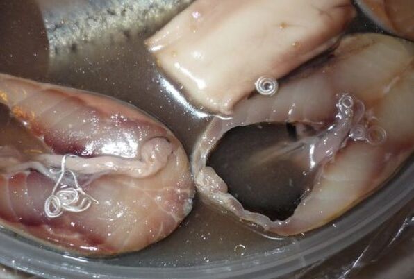 ways of infecting humans with parasites