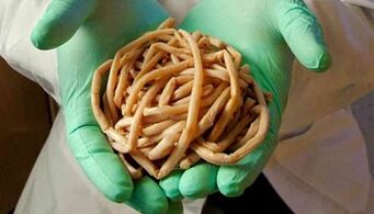 Methods to eliminate parasites from the body